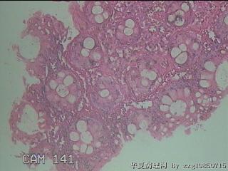直乙结肠粘膜图20