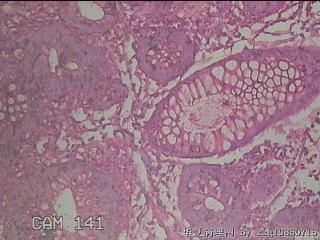 直乙结肠粘膜图31