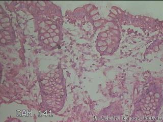直乙结肠粘膜图35