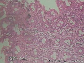 直乙结肠粘膜图23