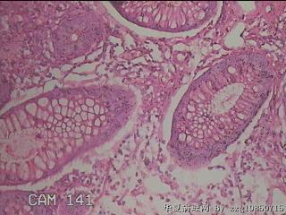 直乙结肠粘膜图33