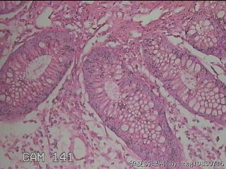 直乙结肠粘膜图36