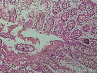 直乙结肠粘膜图16