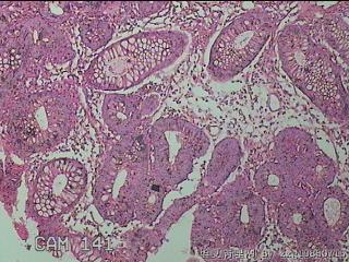 直乙结肠粘膜图17