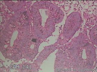 直乙结肠粘膜图32