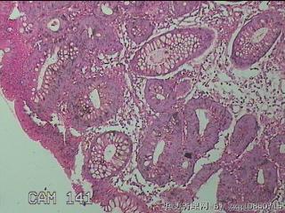 直乙结肠粘膜图15