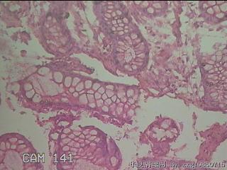直乙结肠粘膜图34