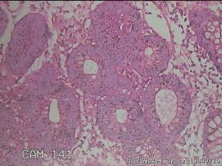 直乙结肠粘膜图37