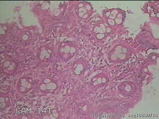 直乙结肠粘膜图27
