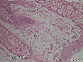 直乙结肠粘膜图42