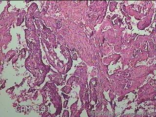 部分胎盘组织图21