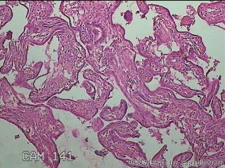 部分胎盘组织图12