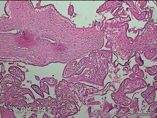 部分胎盘组织图5