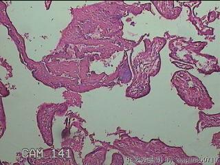 部分胎盘组织图9