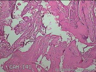 部分胎盘组织图15