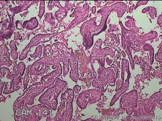 部分胎盘组织图3
