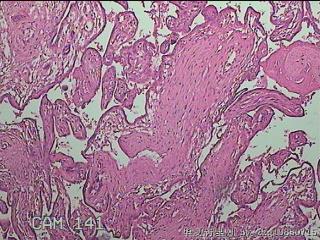 部分胎盘组织图16