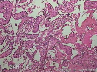 部分胎盘组织图1