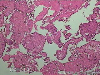 部分胎盘组织图30