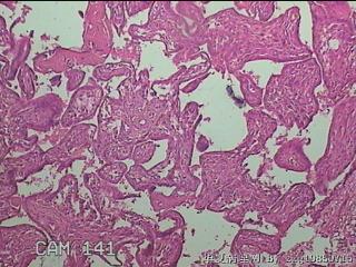 部分胎盘组织图8