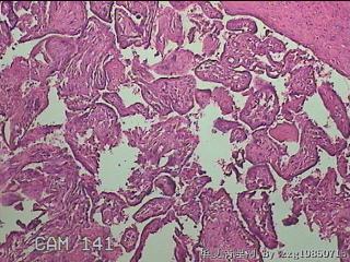 部分胎盘组织图20