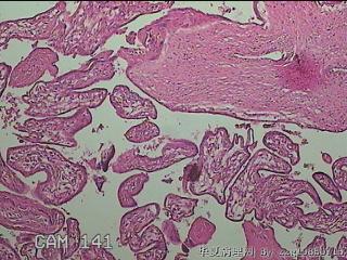 部分胎盘组织图10