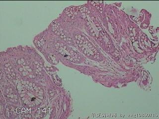 直肠粘膜图4