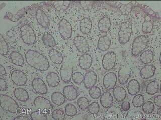 直乙结肠粘膜图7