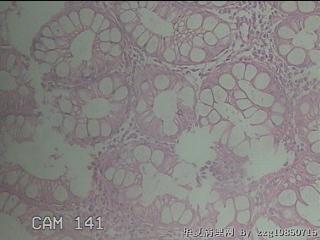 直乙结肠粘膜图25