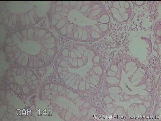 直乙结肠粘膜图24