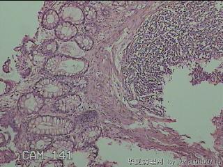 直肠粘膜图14