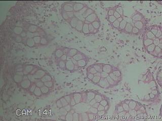 直乙结肠粘膜图13