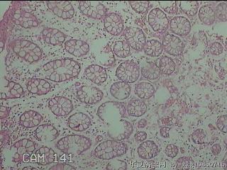 直乙结肠粘膜图1