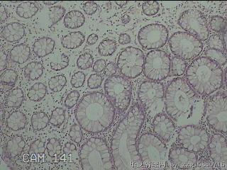 直乙结肠粘膜图6