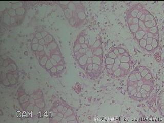 直乙结肠粘膜图15