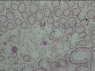 直乙结肠粘膜图8