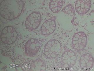 直乙结肠粘膜图18