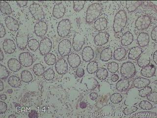 直乙结肠粘膜图12
