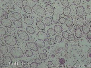 直乙结肠粘膜图5