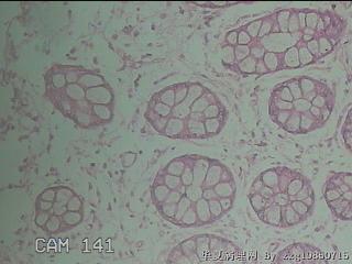 直肠粘膜图14