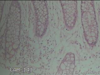 直肠粘膜图28