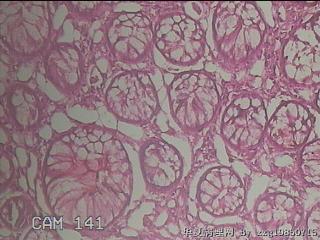 距肛门20cm粘膜图14