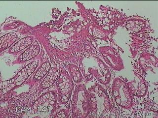 横结肠中段粘膜图5