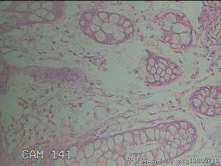 直肠粘膜图21