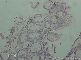 横结肠粘膜图13