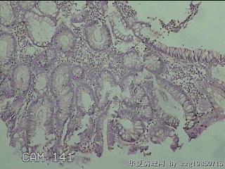 横结肠粘膜图10