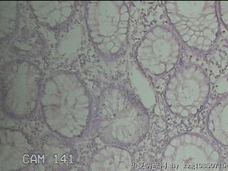 横结肠粘膜图27