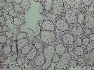 横结肠粘膜图7