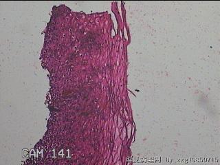 食管粘膜图4