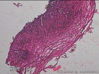 食管粘膜图5